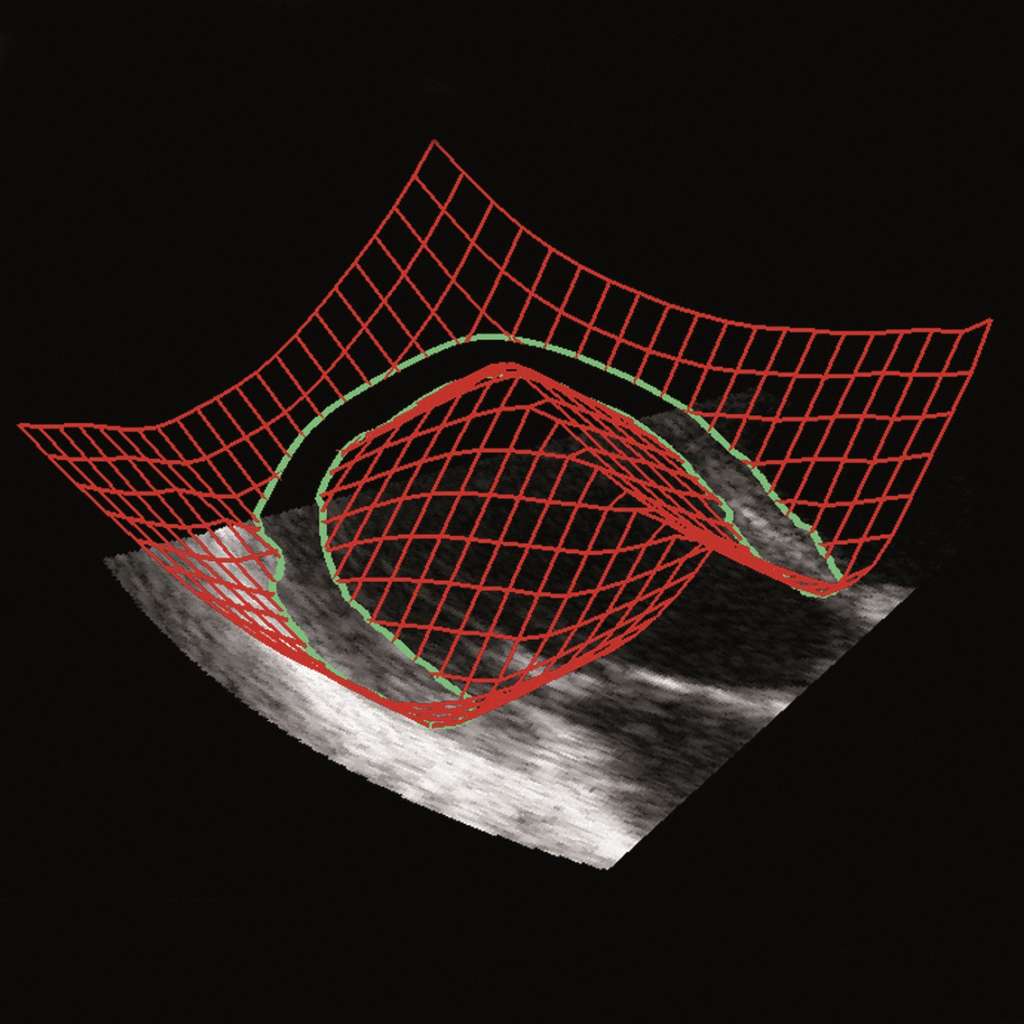 L'échographie, une aide au diagnostic